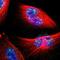 Promyelocytic Leukemia antibody, NBP1-87783, Novus Biologicals, Immunocytochemistry image 