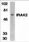 Interleukin-1 receptor-associated kinase-like 2 antibody, 2213, ProSci, Western Blot image 