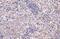 Cytotoxic T-Lymphocyte Associated Protein 4 antibody, GTX134527, GeneTex, Immunohistochemistry paraffin image 