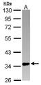 PIN2 (TERF1) Interacting Telomerase Inhibitor 1 antibody, LS-C155457, Lifespan Biosciences, Western Blot image 