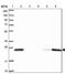 Rho GDP Dissociation Inhibitor Beta antibody, NBP2-33608, Novus Biologicals, Western Blot image 