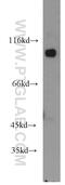 Catenin alpha-3 antibody, 13974-1-AP, Proteintech Group, Western Blot image 