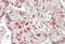 MAX Dimerization Protein MLX antibody, MBS421756, MyBioSource, Immunohistochemistry paraffin image 