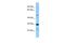 Signal Regulatory Protein Beta 2 antibody, PA5-45920, Invitrogen Antibodies, Western Blot image 