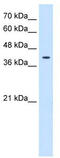 Tetraspanin 12 antibody, TA341907, Origene, Western Blot image 