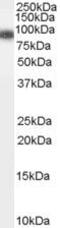 Gelsolin antibody, PA5-18605, Invitrogen Antibodies, Western Blot image 