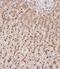 Gus antibody, A02234, Boster Biological Technology, Immunohistochemistry paraffin image 