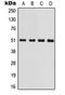 Glycogen Synthase Kinase 3 Alpha antibody, LS-C359015, Lifespan Biosciences, Western Blot image 