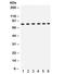 Transient Receptor Potential Cation Channel Subfamily V Member 5 antibody, R32330, NSJ Bioreagents, Western Blot image 