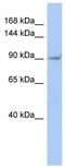 Transient Receptor Potential Cation Channel Subfamily V Member 4 antibody, ab94868, Abcam, Western Blot image 