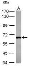 DEAD-Box Helicase 28 antibody, PA5-30762, Invitrogen Antibodies, Western Blot image 