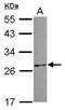 Coiled-Coil Domain Containing 28B antibody, GTX119746, GeneTex, Western Blot image 
