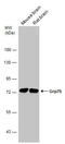 mtHSP70 antibody, GTX133283, GeneTex, Western Blot image 