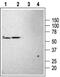 Potassium Two Pore Domain Channel Subfamily K Member 3 antibody, PA5-77589, Invitrogen Antibodies, Western Blot image 