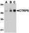 C1q And TNF Related 5 antibody, PA5-20152, Invitrogen Antibodies, Western Blot image 
