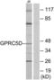 G Protein-Coupled Receptor Class C Group 5 Member D antibody, LS-C120706, Lifespan Biosciences, Western Blot image 