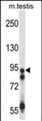 Ubiquitin Specific Peptidase 20 antibody, PA5-71898, Invitrogen Antibodies, Western Blot image 