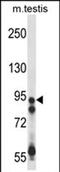 Ubiquitin Specific Peptidase 20 antibody, PA5-71898, Invitrogen Antibodies, Western Blot image 