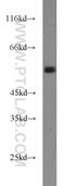 RUNX Family Transcription Factor 1 antibody, 19555-1-AP, Proteintech Group, Western Blot image 