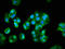 Phosphatidylinositol-4,5-Bisphosphate 3-Kinase Catalytic Subunit Alpha antibody, LS-C670921, Lifespan Biosciences, Immunofluorescence image 