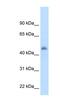 Cytochrome P450 Family 3 Subfamily A Member 7 antibody, NBP1-62387, Novus Biologicals, Western Blot image 