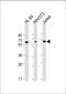Malic Enzyme 2 antibody, M01380, Boster Biological Technology, Western Blot image 