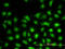 Ubiquitin Conjugating Enzyme E2 L3 antibody, LS-C198398, Lifespan Biosciences, Immunofluorescence image 