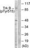 BDNF/NT-3 growth factors receptor antibody, TA311826, Origene, Western Blot image 