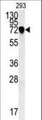 Neuron Derived Neurotrophic Factor antibody, LS-C168140, Lifespan Biosciences, Western Blot image 