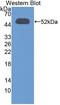 3-Oxoacid CoA-Transferase 1 antibody, LS-C373581, Lifespan Biosciences, Western Blot image 