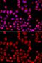 Cdc42 Guanine Nucleotide Exchange Factor 9 antibody, GTX33018, GeneTex, Immunocytochemistry image 