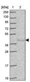 Hyaluronidase 3 antibody, PA5-61956, Invitrogen Antibodies, Western Blot image 