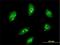 Mesenchyme Homeobox 2 antibody, H00004223-M10, Novus Biologicals, Immunocytochemistry image 