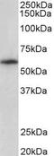 TXK Tyrosine Kinase antibody, GTX47607, GeneTex, Western Blot image 