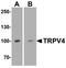 Transient Receptor Potential Cation Channel Subfamily V Member 4 antibody, A00565, Boster Biological Technology, Western Blot image 