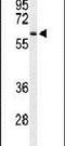 Sorting Nexin 27 antibody, PA5-26946, Invitrogen Antibodies, Western Blot image 