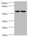 Collapsin Response Mediator Protein 1 antibody, orb351897, Biorbyt, Western Blot image 