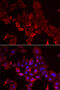 Myotilin antibody, 22-222, ProSci, Immunofluorescence image 