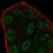 Zinc Finger MYM-Type Containing 6 antibody, HPA071865, Atlas Antibodies, Immunofluorescence image 