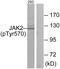 Janus Kinase 2 antibody, PA5-38287, Invitrogen Antibodies, Western Blot image 