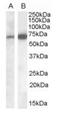 CADM4 antibody, orb19717, Biorbyt, Western Blot image 