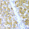 TIR Domain Containing Adaptor Protein antibody, LS-C331780, Lifespan Biosciences, Immunohistochemistry paraffin image 