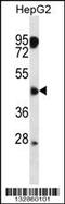 CXADR Like Membrane Protein antibody, 56-810, ProSci, Western Blot image 