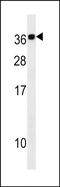 Calcium Binding Protein 2 antibody, PA5-49161, Invitrogen Antibodies, Western Blot image 