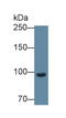 Complement Factor B antibody, LS-C299905, Lifespan Biosciences, Western Blot image 