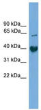 Transmembrane Protein 130 antibody, TA329619, Origene, Western Blot image 