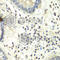 Protein Arginine Methyltransferase 5 antibody, A1520, ABclonal Technology, Immunohistochemistry paraffin image 