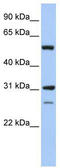 Inosine Monophosphate Dehydrogenase 1 antibody, TA335348, Origene, Western Blot image 