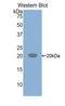 Colony Stimulating Factor 1 Receptor antibody, LS-B15845, Lifespan Biosciences, Western Blot image 