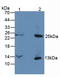 Pro-Platelet Basic Protein antibody, LS-C292382, Lifespan Biosciences, Western Blot image 